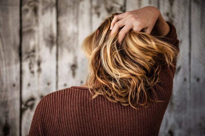 Kako anemija utiče na opadanje kose?