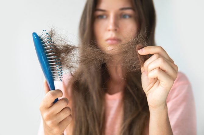 Nasledni gubitak kose kod žena, Šta treba da znate