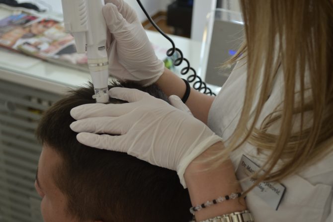 Mezoterapija kose – cena, iskustva, rezultati